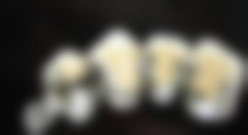 绍兴柯桥钱杨口腔门诊擅长项目。