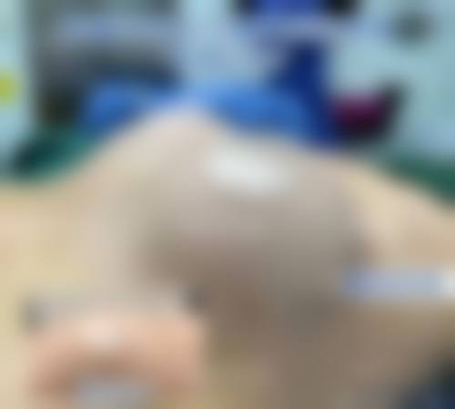 沈阳艾薇医疗美容诊所更擅长什么手术