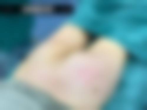佳木斯赫蒂整形医院治疗反馈与口碑评价。