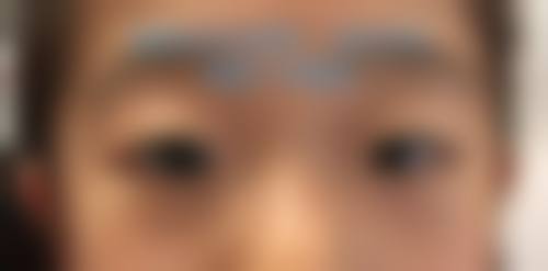 聊城市中 心医院眼科治疗反馈与口碑评价。