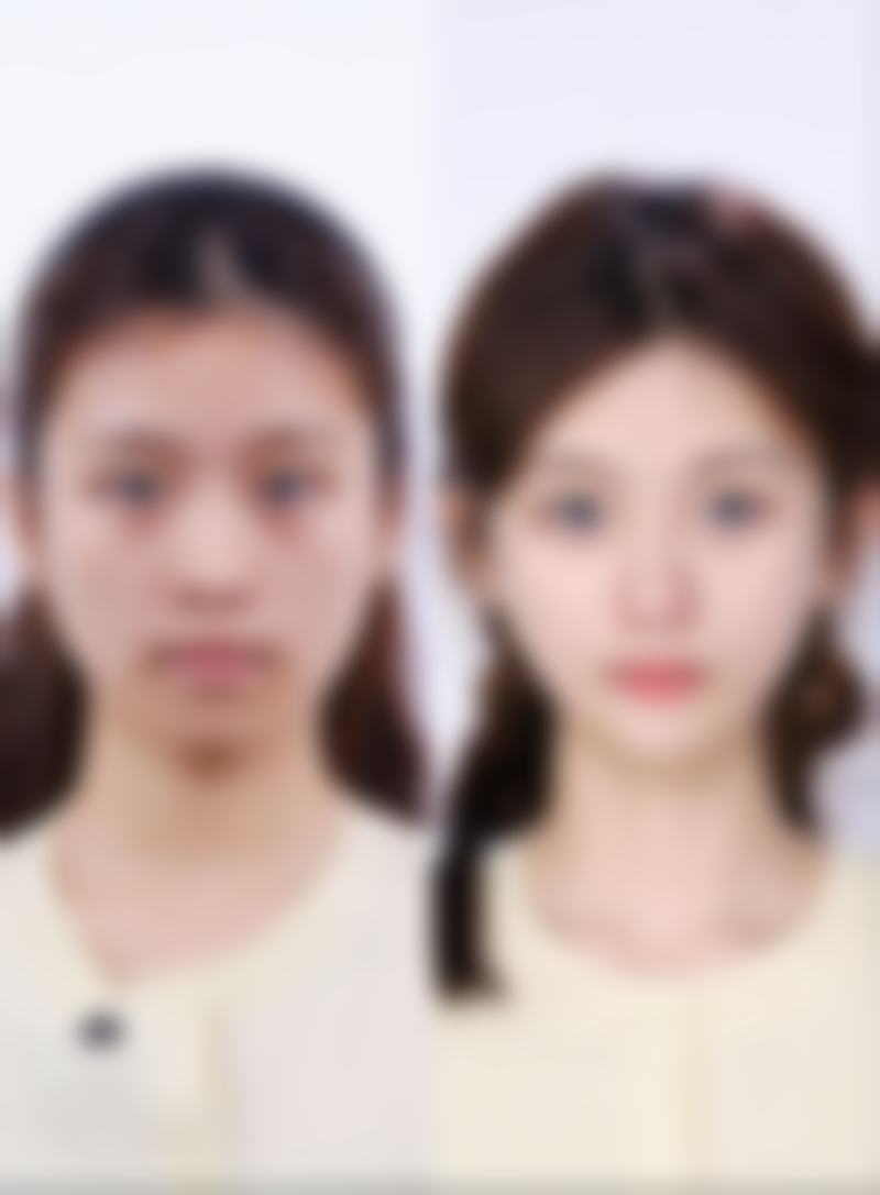 韩新鸣医生技术实力