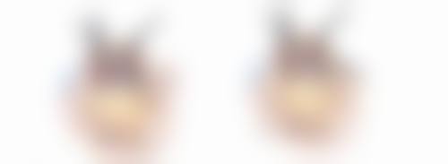 重庆好美整形医疗美容医院真实患者口碑评价