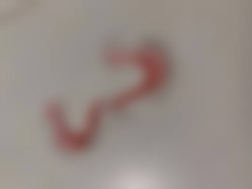 临床实例分享