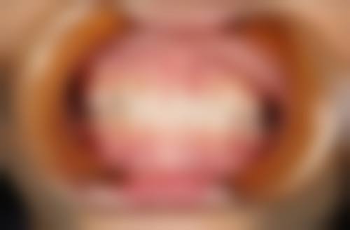 绍兴越城口腔医院擅长项目。