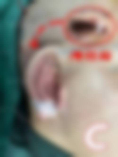 曹倍正医生做手术价格