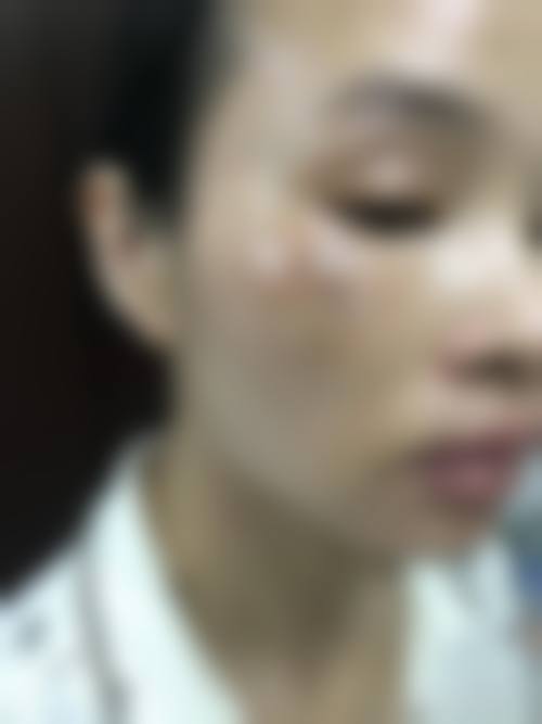 管城拉斐尔医疗美容诊所评价