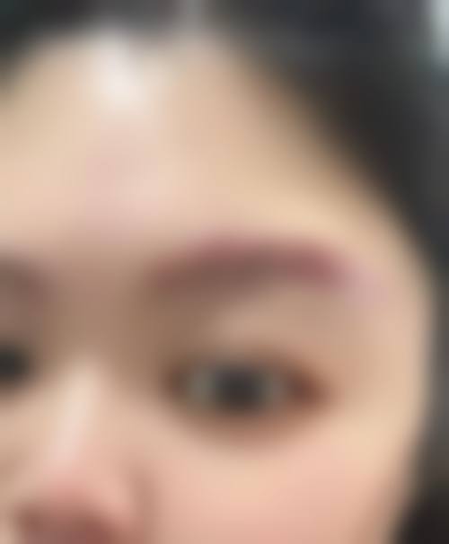 苏州壹秒医疗美容治疗反馈与口碑评价。