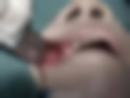 安徽宣城宛陵口腔擅长项目。