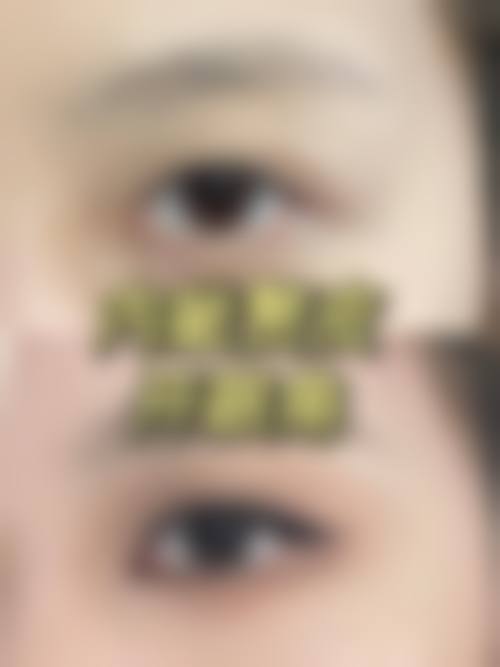 保定市第二医院眼科预约挂号方式。