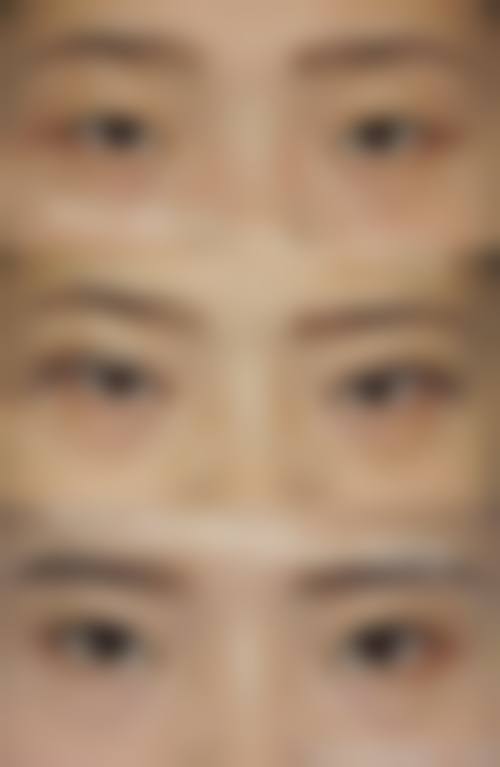 保定市第二医院眼科擅长项目。
