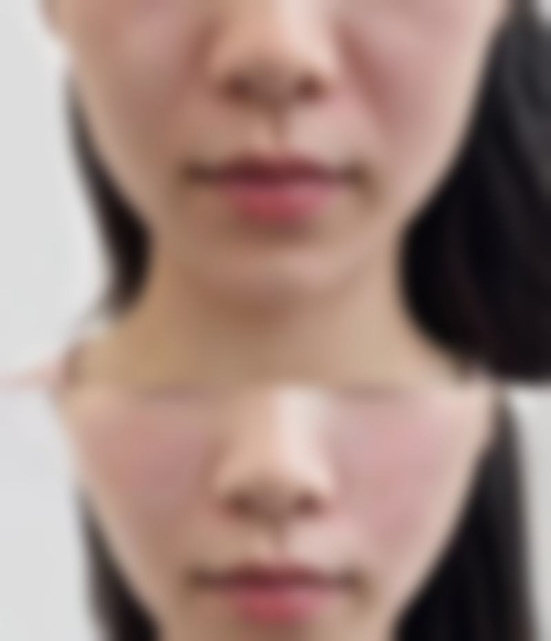 重庆好美整形医疗美容医院口碑评价