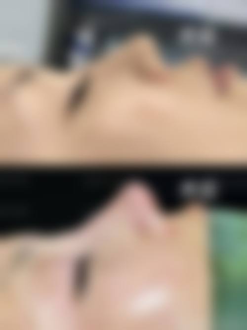 李进超医生口碑如何