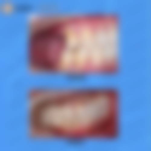 擅长项目详解