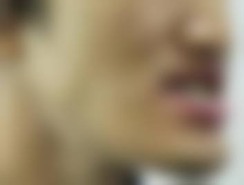 合肥牙一生口腔门诊部擅长项目
