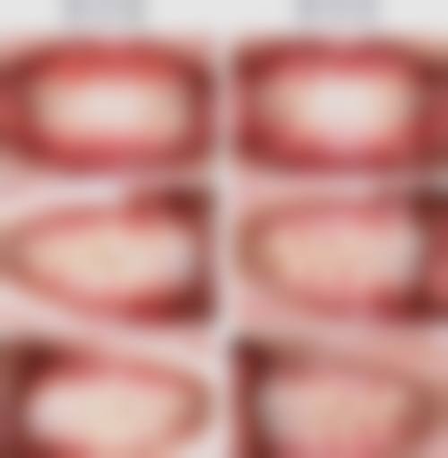 宁夏吴忠宋涛口腔诊所治疗反馈与口碑评价。