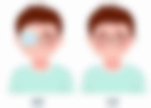 桂林181医院眼科擅长项目。