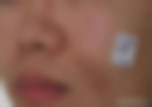 西安亚太整形医院怎么样之基本信息