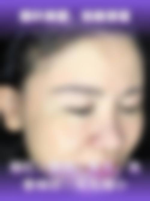 郑州欧兰整形美容医院预约挂号方式。