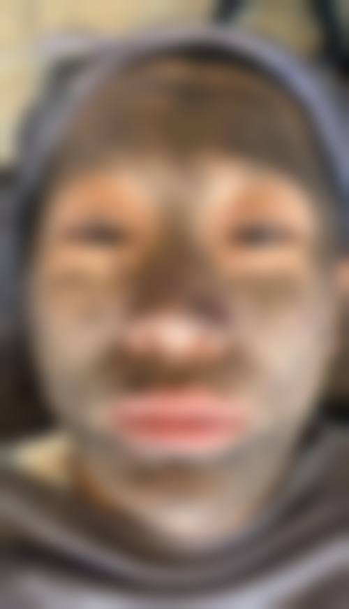 临床实例分享