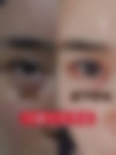 临床实例分享