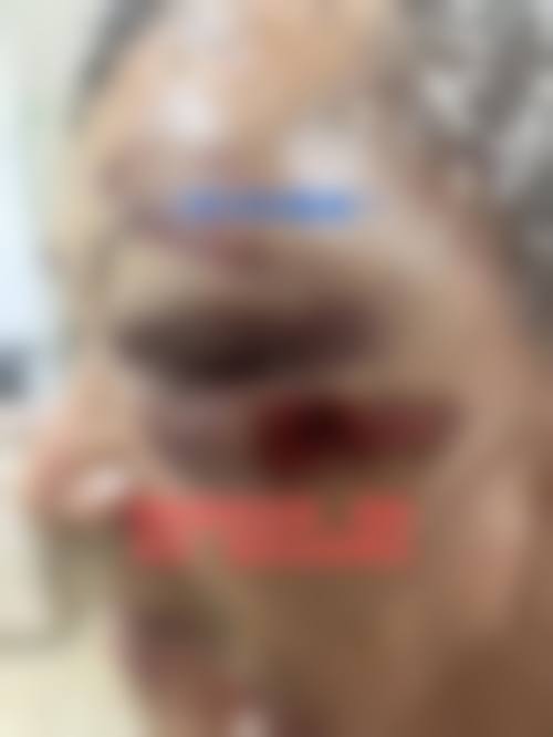达川区人民医院眼科预约挂号方式。