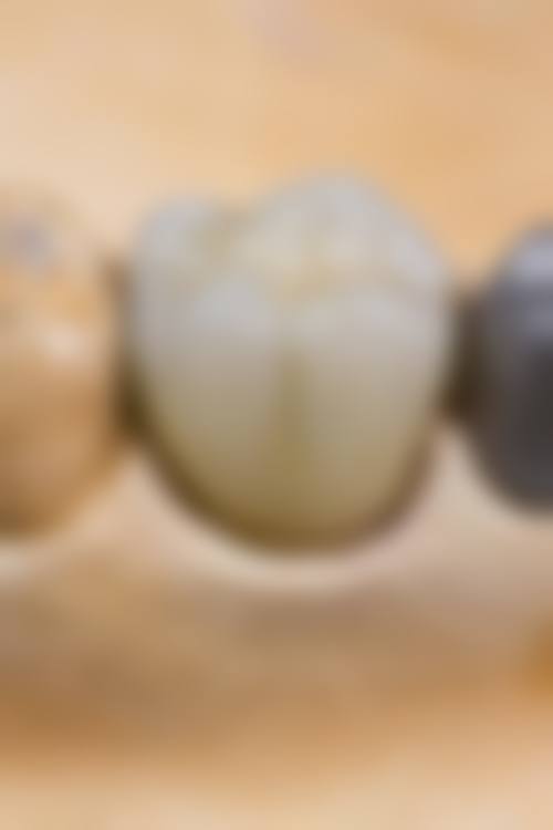 设备环境介绍:数字化诊疗,保护精细与舒适