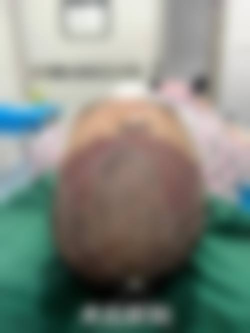 优惠活动详情:开启您的颜面焕新之旅