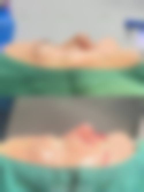 楚雄尚韩医疗美容诊所治疗反馈与口碑评价。