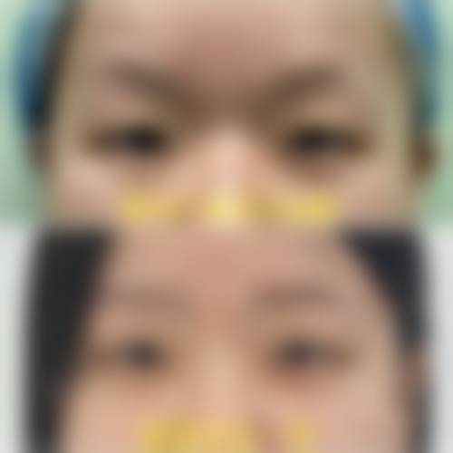 兰州莱尚医疗美容门诊部治疗反馈与口碑评价。