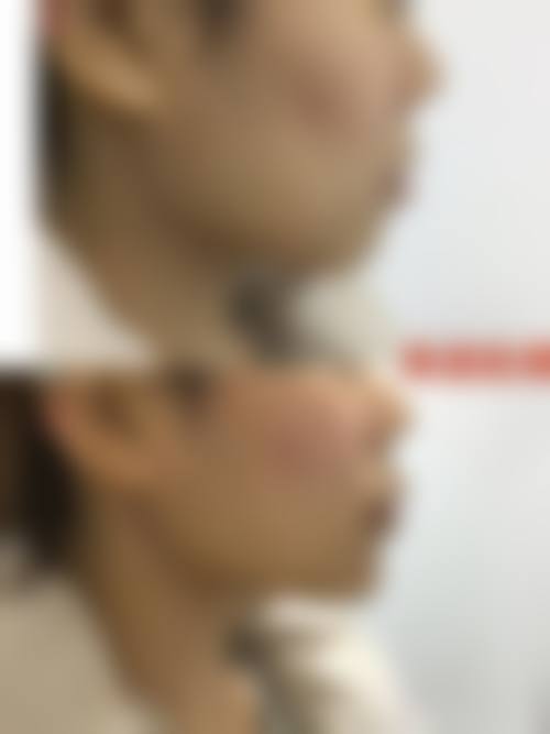 内江百龄京菊医疗美容门诊部项目价格