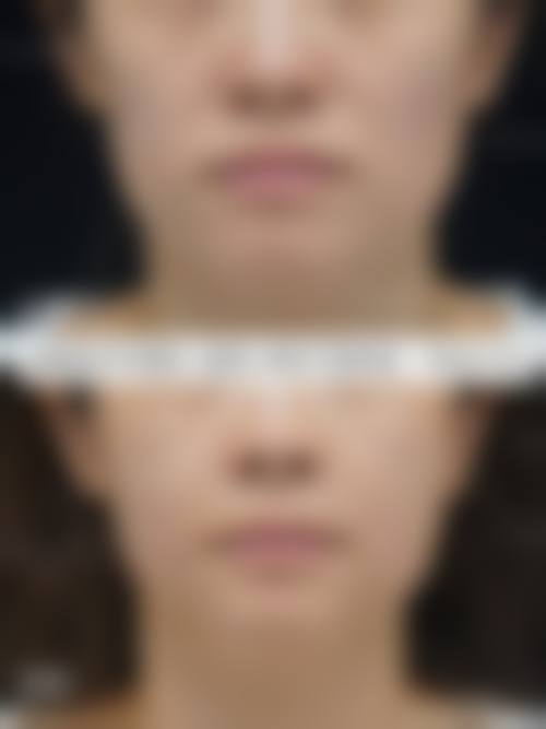 二、特色项目与项目优势:个性化医美解决方案