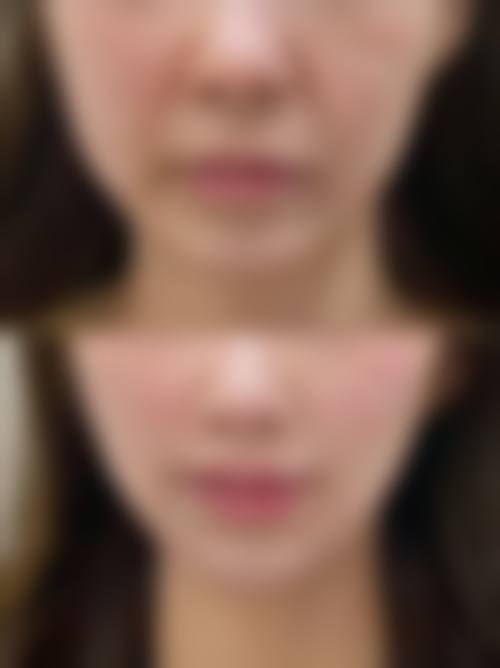 优惠活动详情