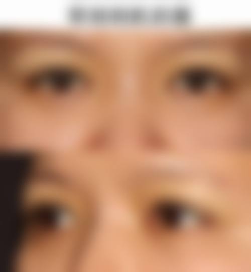 擅长项目详解