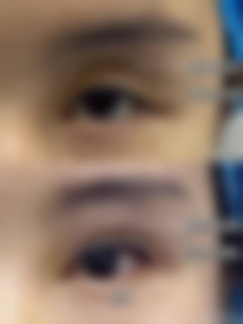 天津首爱眼科门诊部擅长项目。