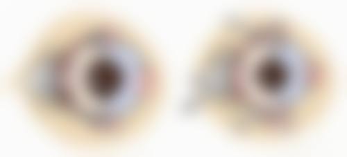 孝感市中 心医院眼科门诊营业时间。