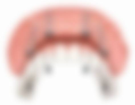 当前优惠活动详情