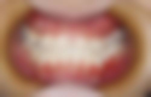 爱康健口腔医院治疗反馈与口碑评价。