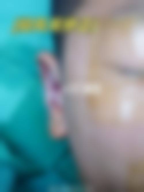 潍坊韩奈姿医疗美容门诊部擅长项目。