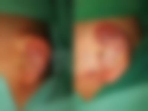宁波鄞州芬迪医疗美容诊所治疗反馈与口碑评价。