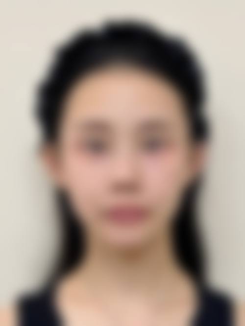 临床实例分享