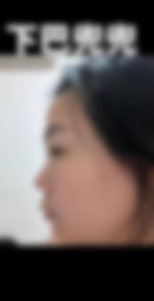 张永义医生的技术实力