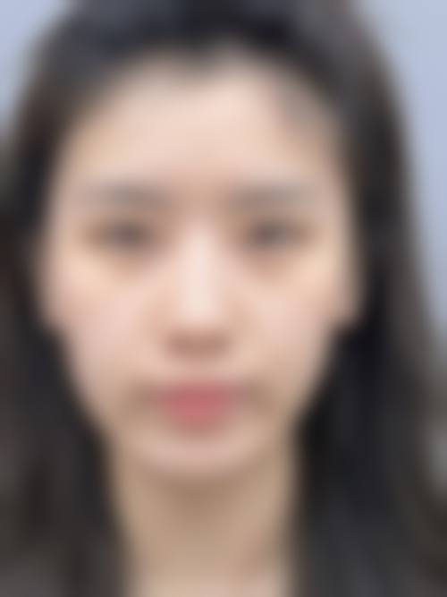 临床实例分享
