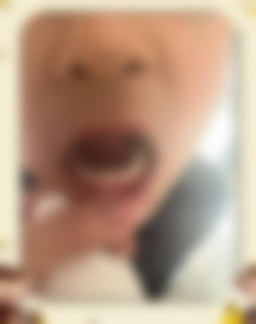 韩仲凯医生技术实力