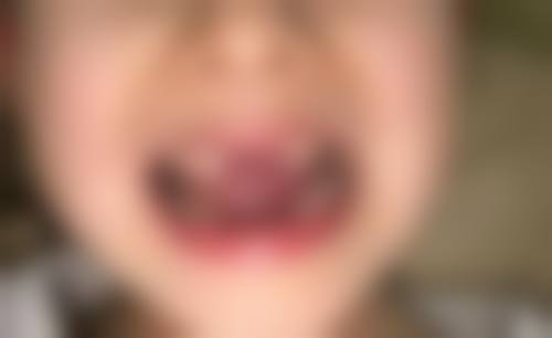 患者真实评价