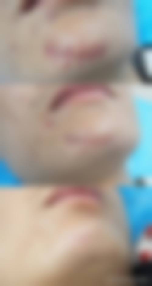 昆明华连众美医疗整形医院擅长项目。