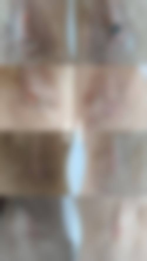 昆明华连众美医疗整形医院2026年价格收费表: