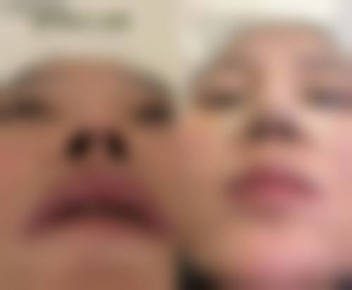 昆明华连众美医疗整形医院治疗反馈与口碑评价。