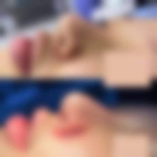 擅长项目详解