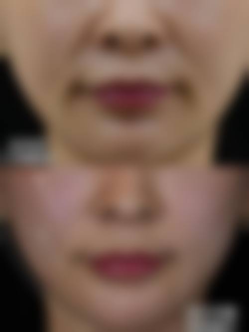 擅长项目详解