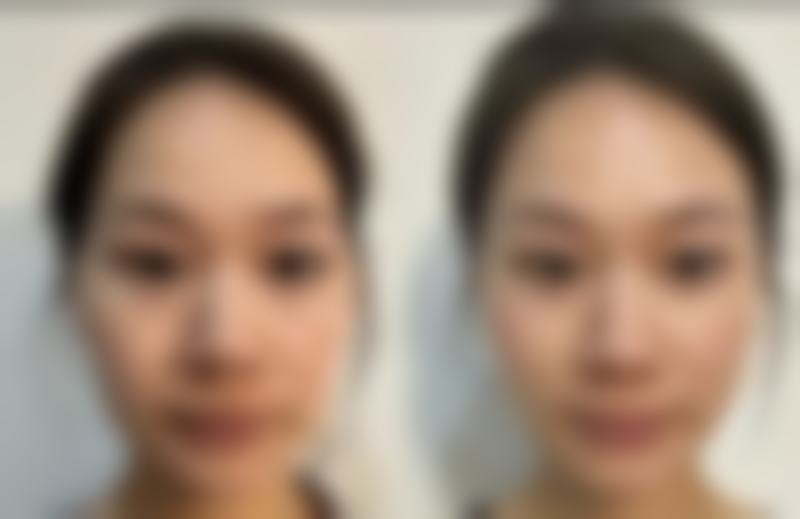 柳州花想容整形医院项目特色